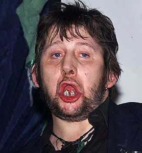 shane-macgowan.jpg